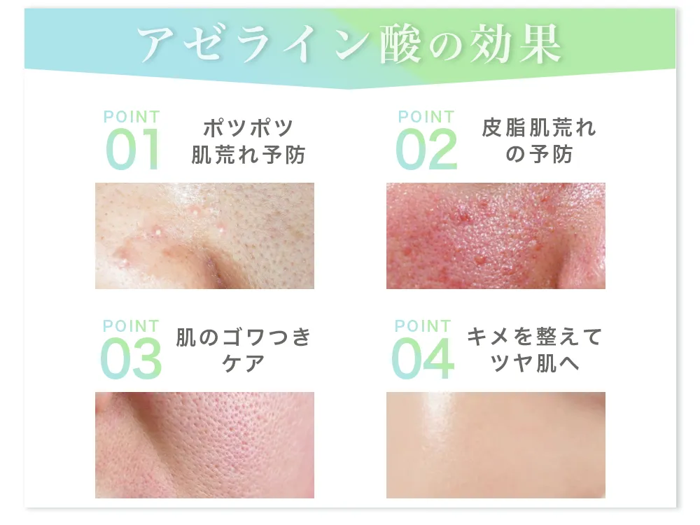 初回価格】アドバンストエッセンスROミニ(10mL)＜美容液＞ | ミニ