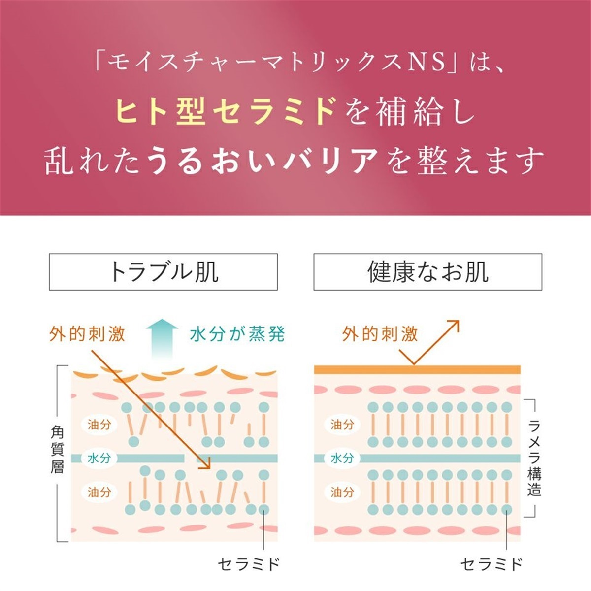 モイスチャーマトリックスNS（30mL）＜保湿美容液＞ | センシティブ