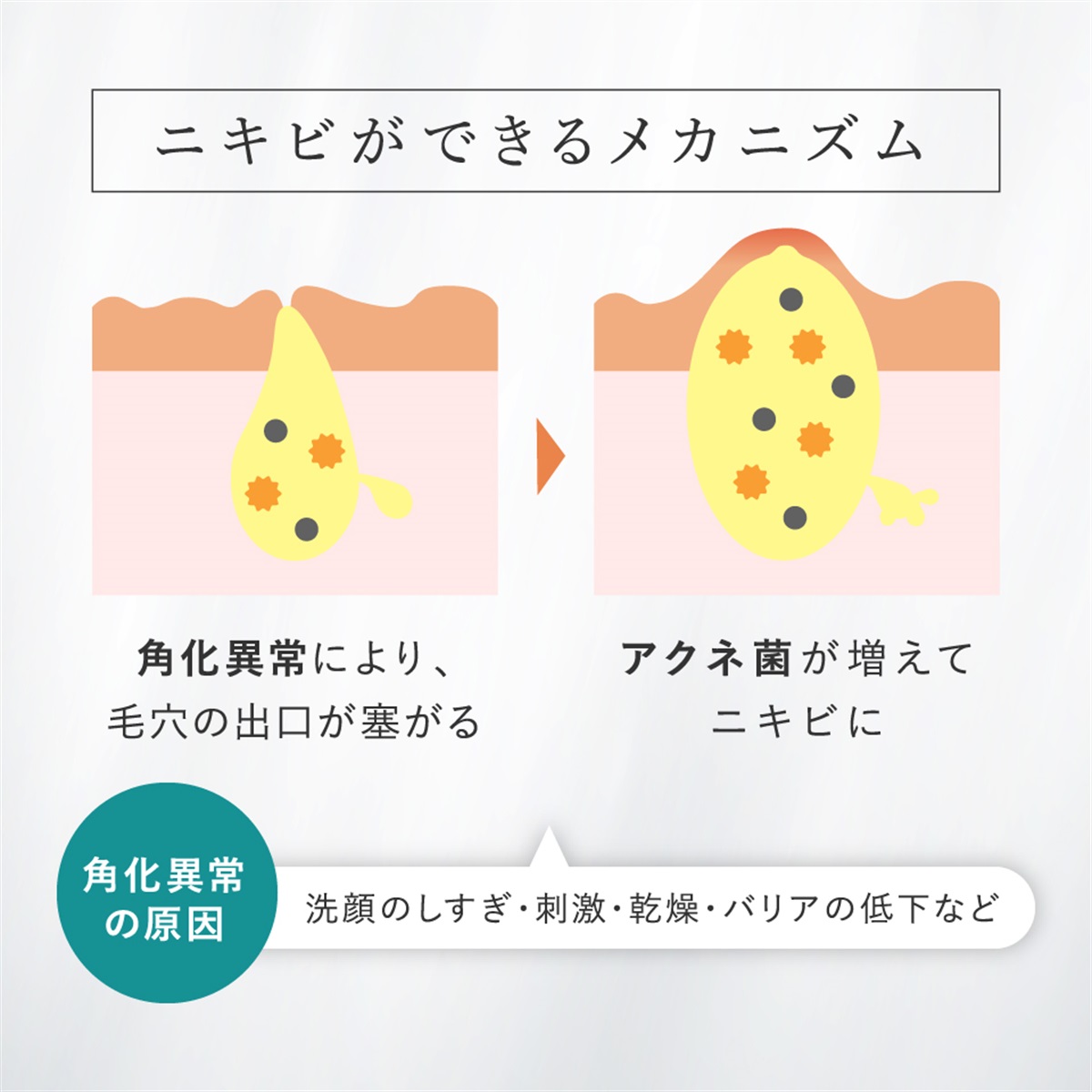 アドバンストエッセンスAZ(30mL)＜美容液＞ | アドバンス